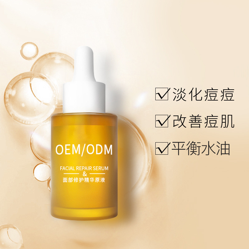 阜阳市_祛痘精华原液OEM